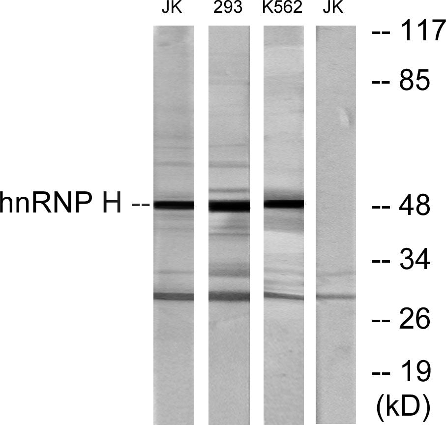 hnRNP H Rabbit Polyclonal Antibody