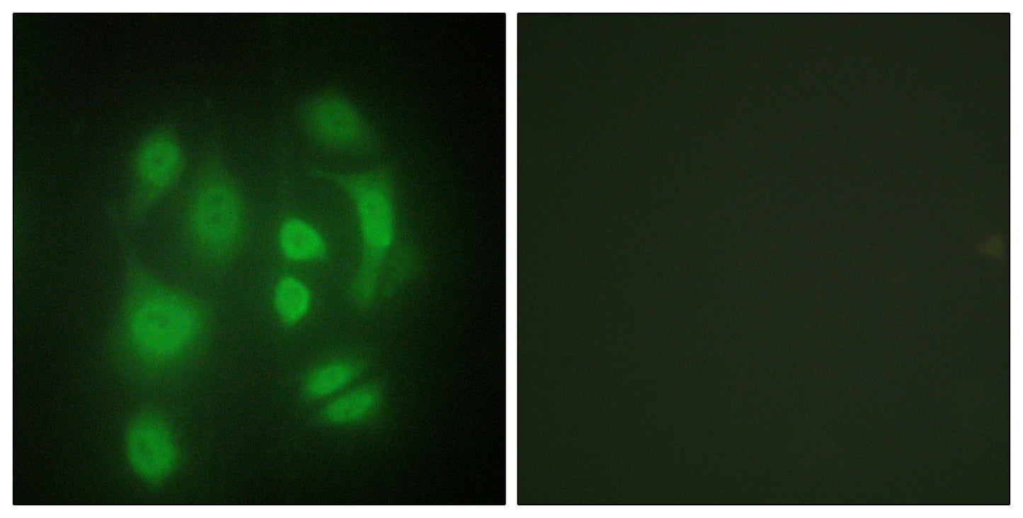 hnRNP Q Rabbit Polyclonal Antibody