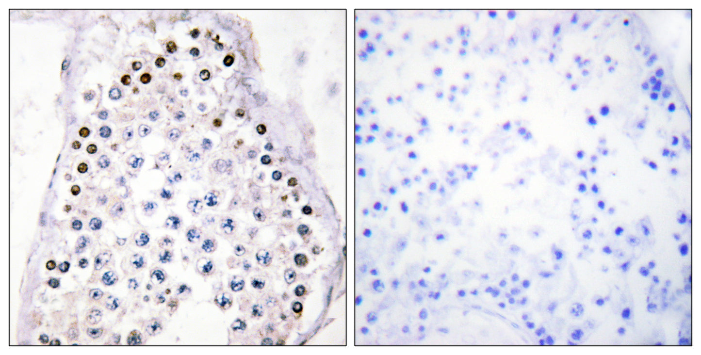 Hox-A1/B1/D1 Rabbit Polyclonal Antibody