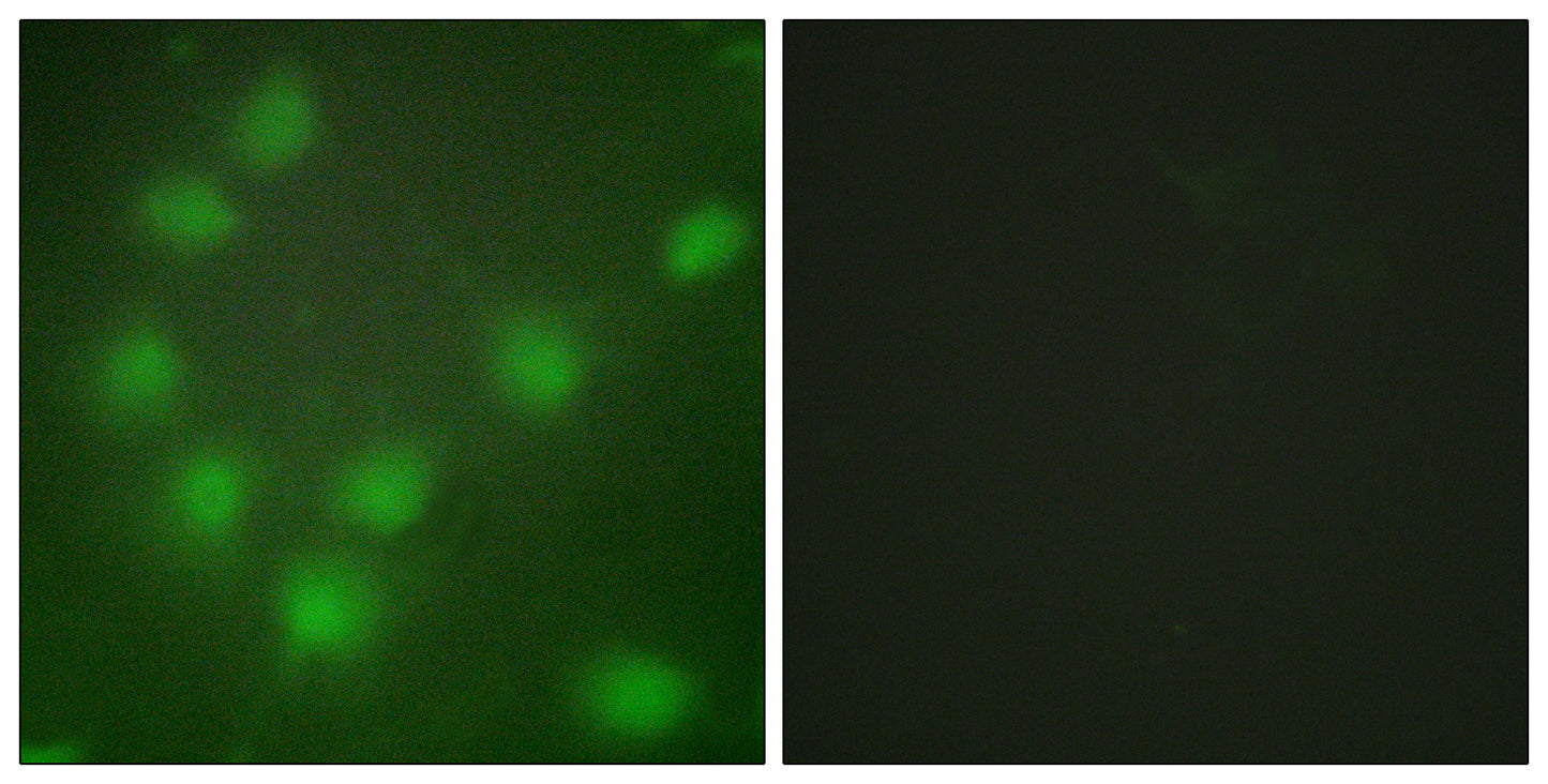 HoxA11/D11 Rabbit Polyclonal Antibody