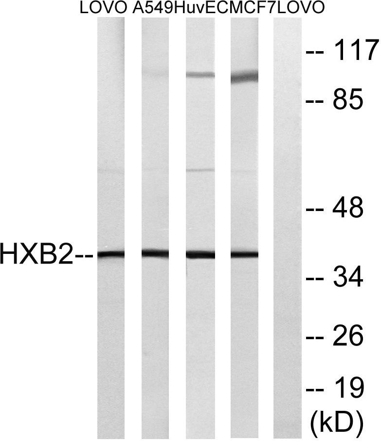 HoxB2 Rabbit Polyclonal Antibody