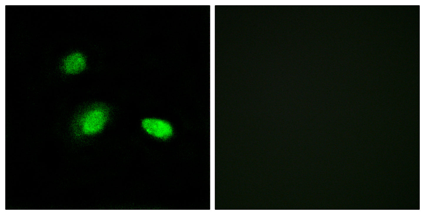 HSP β2 Rabbit Polyclonal Antibody
