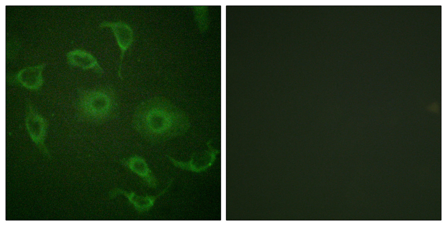 IFN-α/βRα Rabbit Polyclonal Antibody