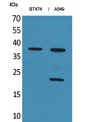 IFN-α1 Rabbit Polyclonal Antibody