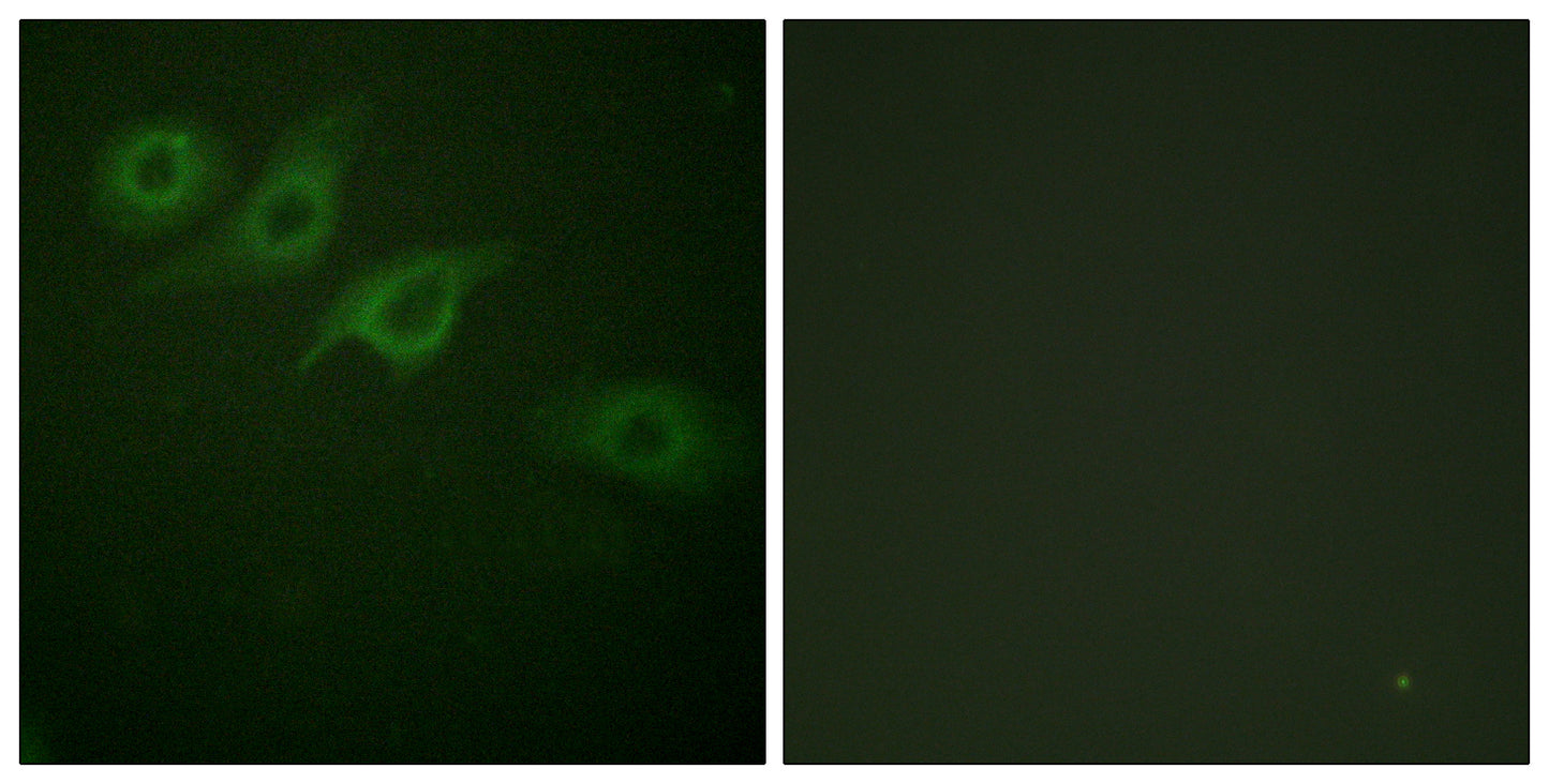 IFN-γRα Rabbit Polyclonal Antibody