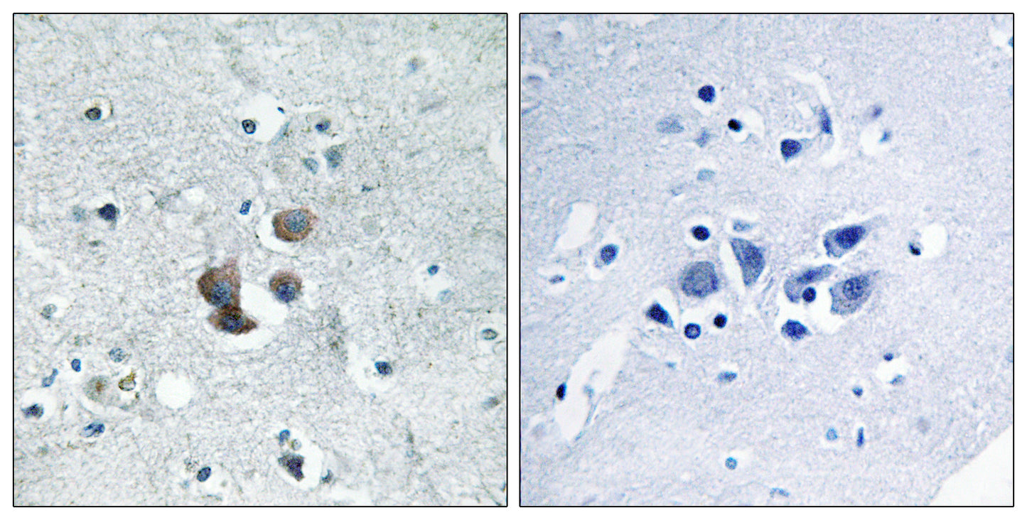IGFBP7 Rabbit Polyclonal Antibody