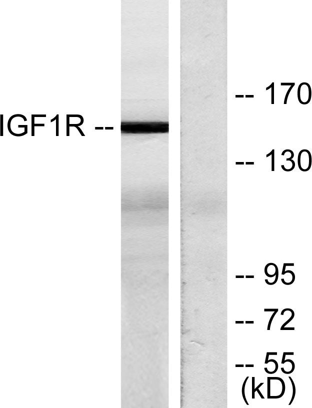 IGF-IR Rabbit Polyclonal Antibody