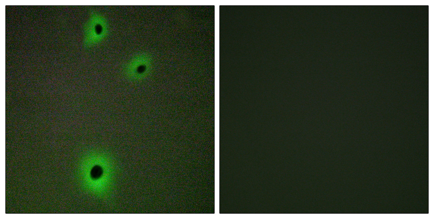 IGSF4C Rabbit Polyclonal Antibody
