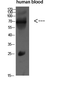 IL16 Rabbit Polyclonal Antibody