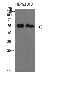 IL-17RB Rabbit Polyclonal Antibody