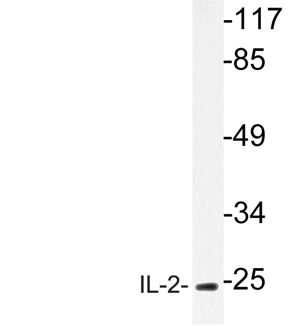 IL-2 Rabbit Polyclonal Antibody