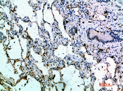 IL-27A Rabbit Polyclonal Antibody