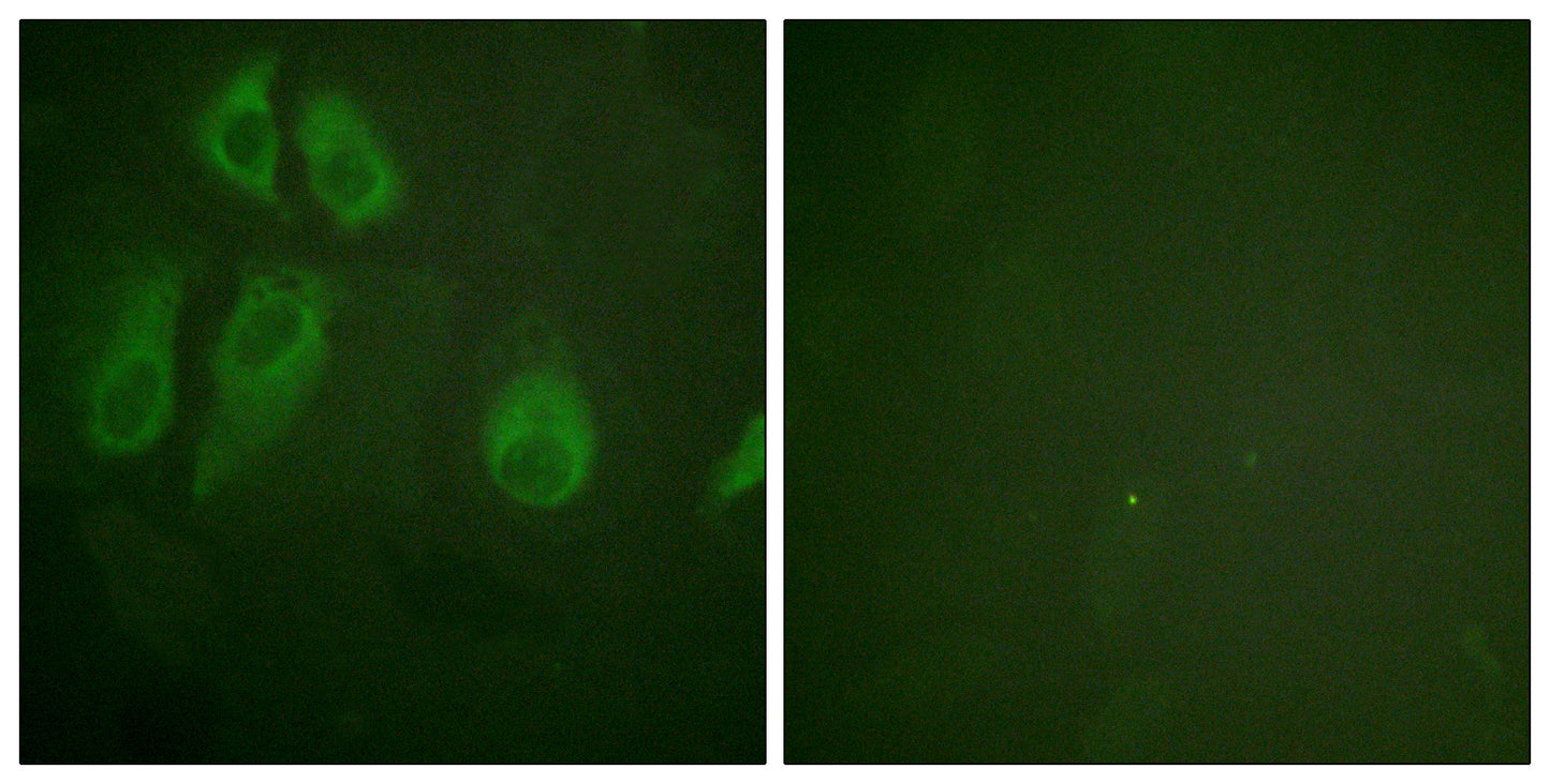 IL-2Rα Rabbit Polyclonal Antibody