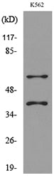 IL-2Rγ Rabbit Polyclonal Antibody