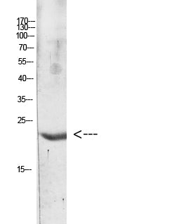 IL-31 Rabbit Polyclonal Antibody