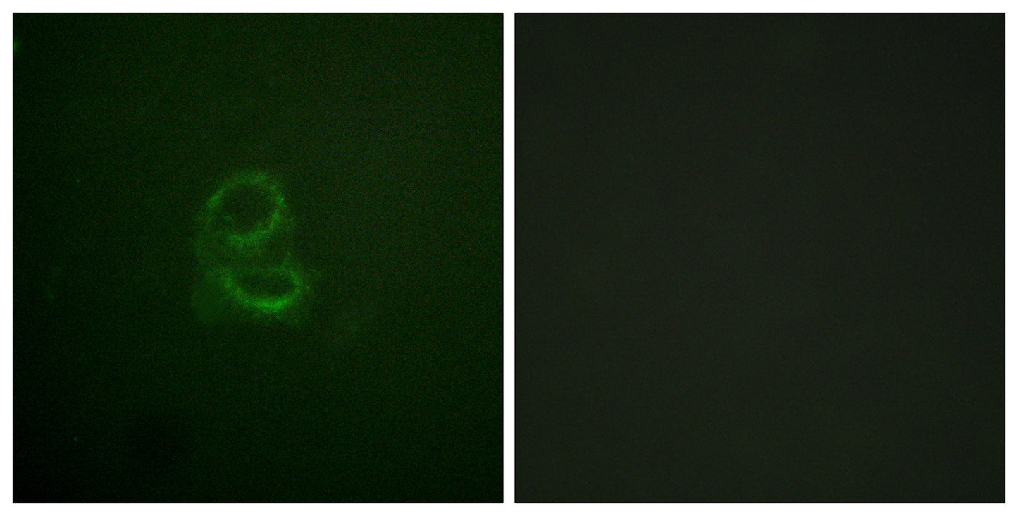 IL-4Rα Rabbit Polyclonal Antibody