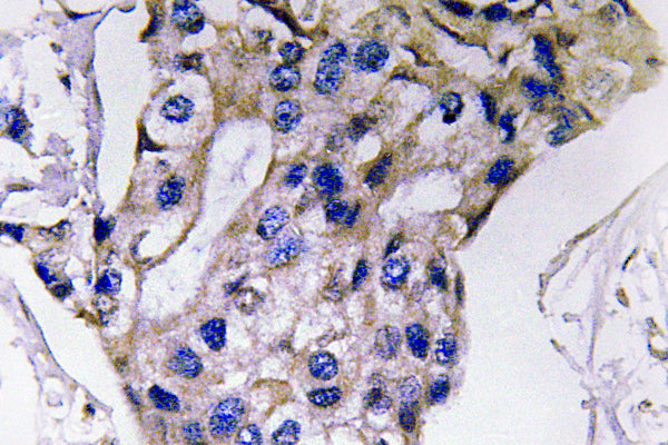 IL-5 Rabbit Polyclonal Antibody