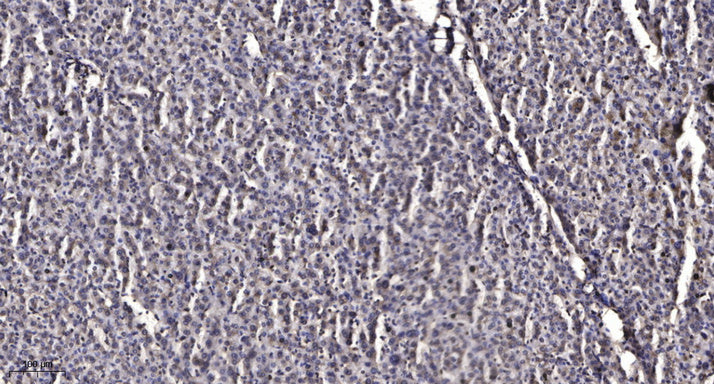 INPP5J Rabbit Polyclonal Antibody
