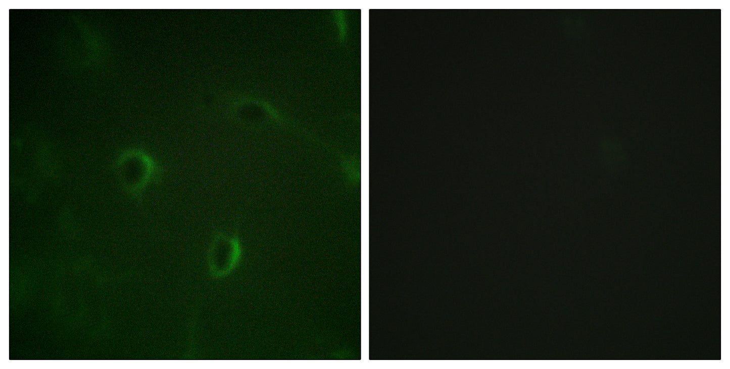 Insulin R Rabbit Polyclonal Antibody