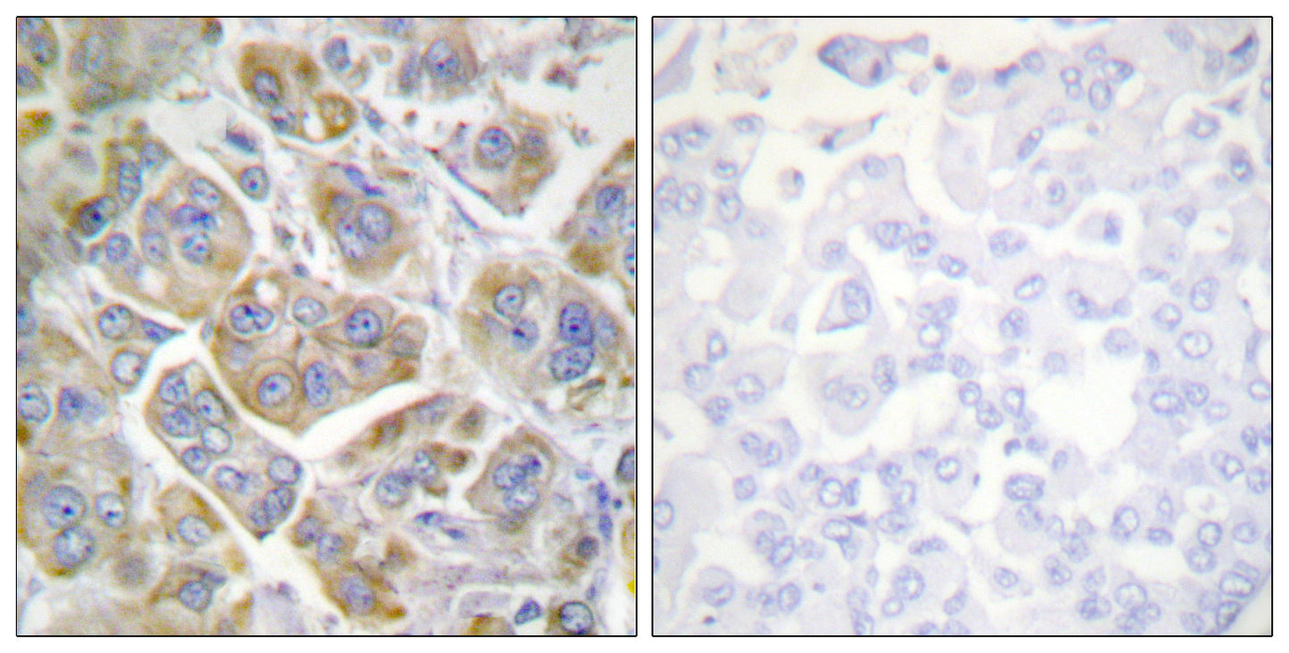 Integrin β4 Rabbit Polyclonal Antibody