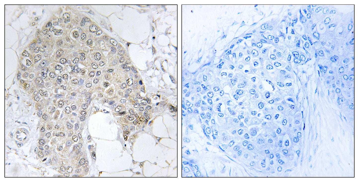 IPP-2 Rabbit Polyclonal Antibody