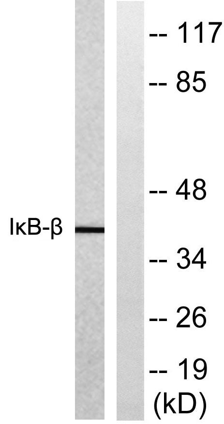 IκB-β Rabbit Polyclonal Antibody
