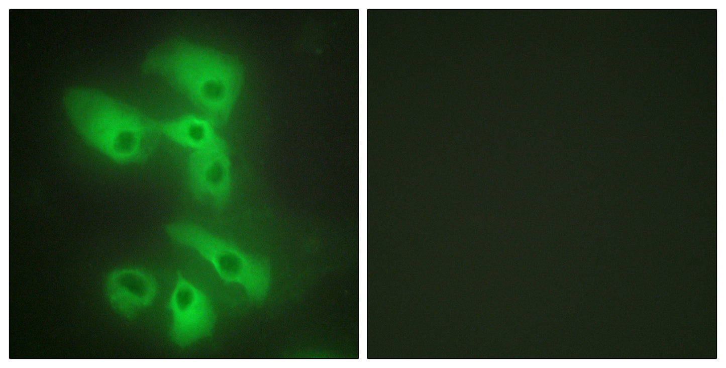 JIP-2 Rabbit Polyclonal Antibody