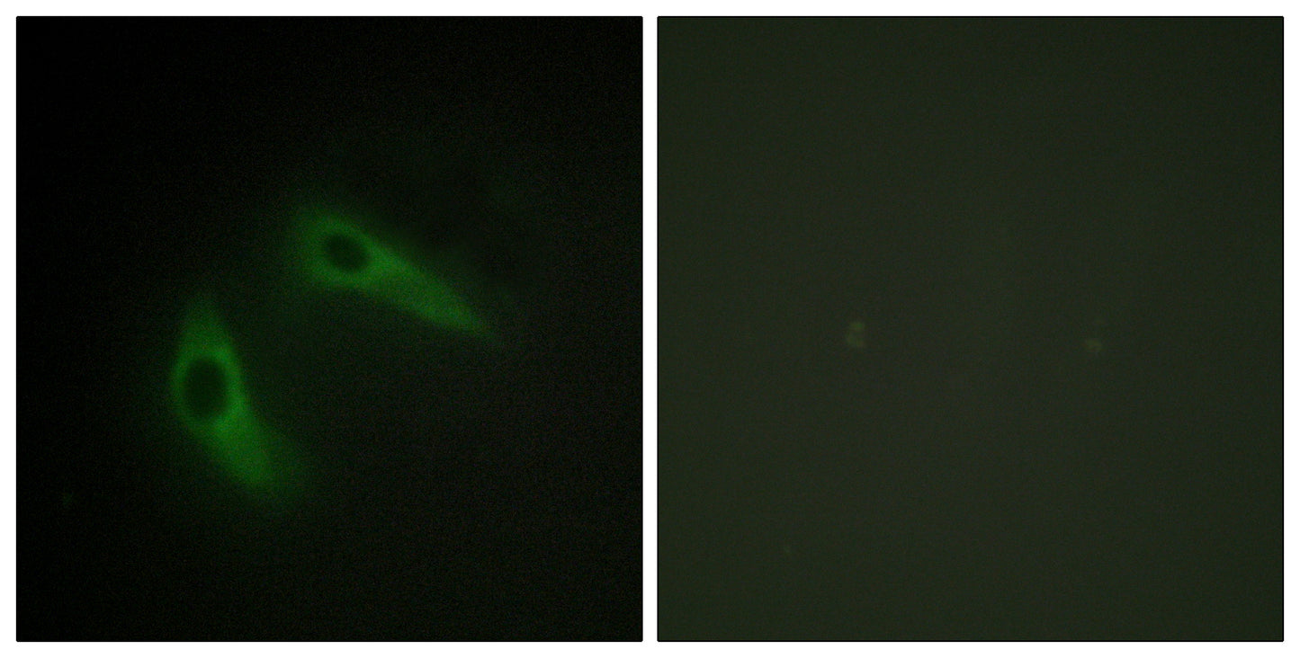 KChIP1 Rabbit Polyclonal Antibody
