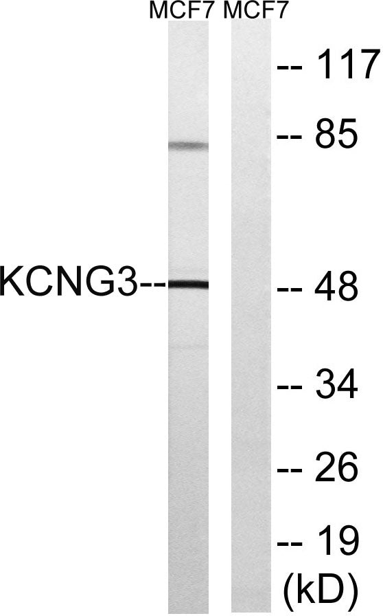 KCNG3 Rabbit Polyclonal Antibody