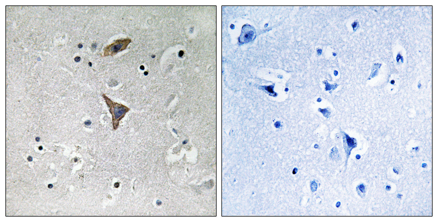 KCNT1 Rabbit Polyclonal Antibody