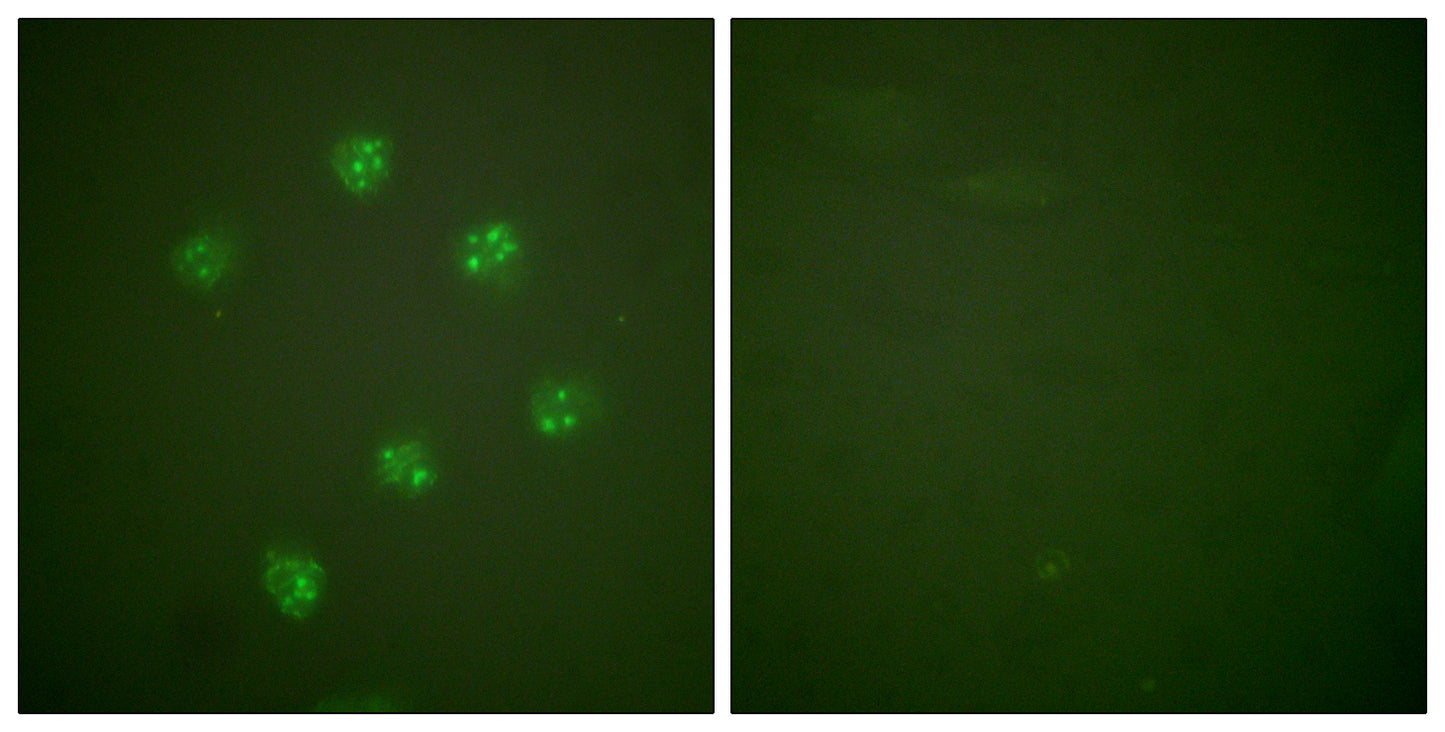Ki-67 Rabbit Polyclonal Antibody