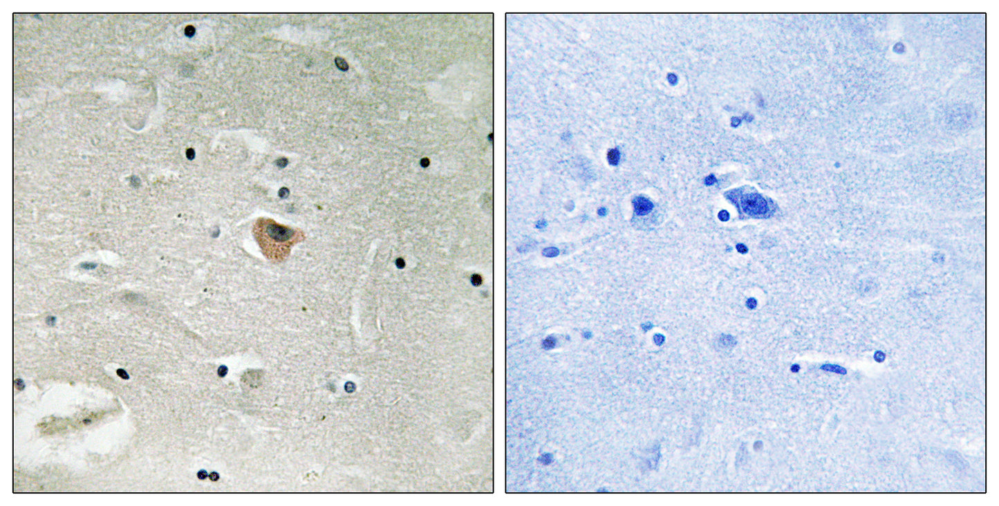 KIF13B Rabbit Polyclonal Antibody