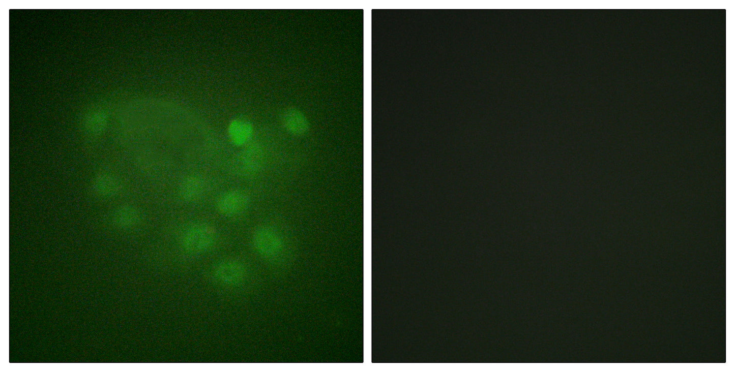 KIF2C Rabbit Polyclonal Antibody