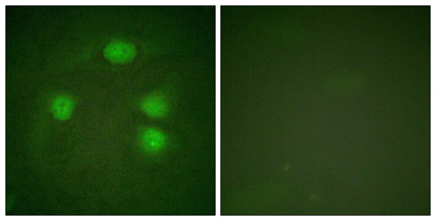 KIR3.1 Rabbit Polyclonal Antibody