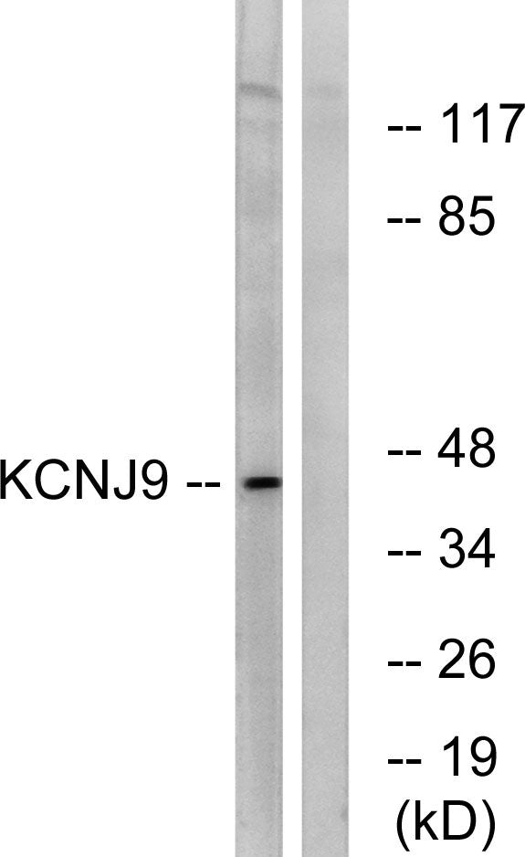 KIR3.3 Rabbit Polyclonal Antibody