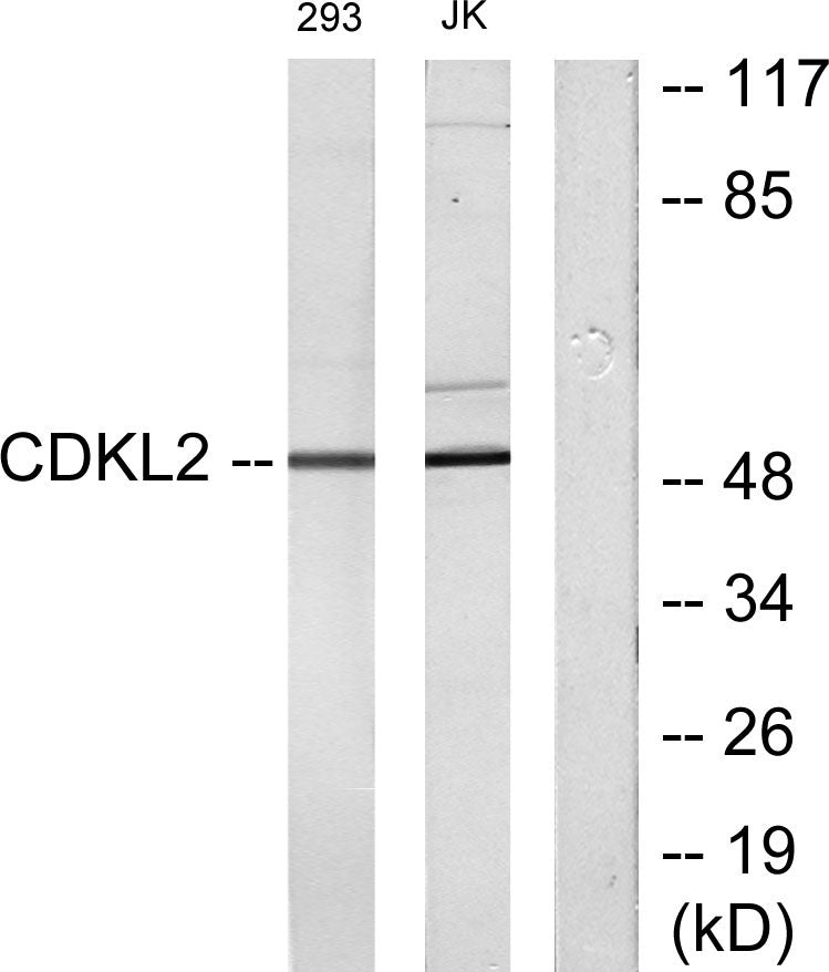 KKIAMRE Rabbit Polyclonal Antibody