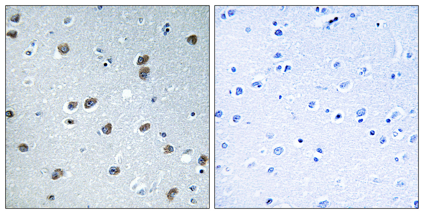 KLHL29 Rabbit Polyclonal Antibody