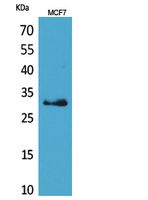 KLK1 Rabbit Polyclonal Antibody