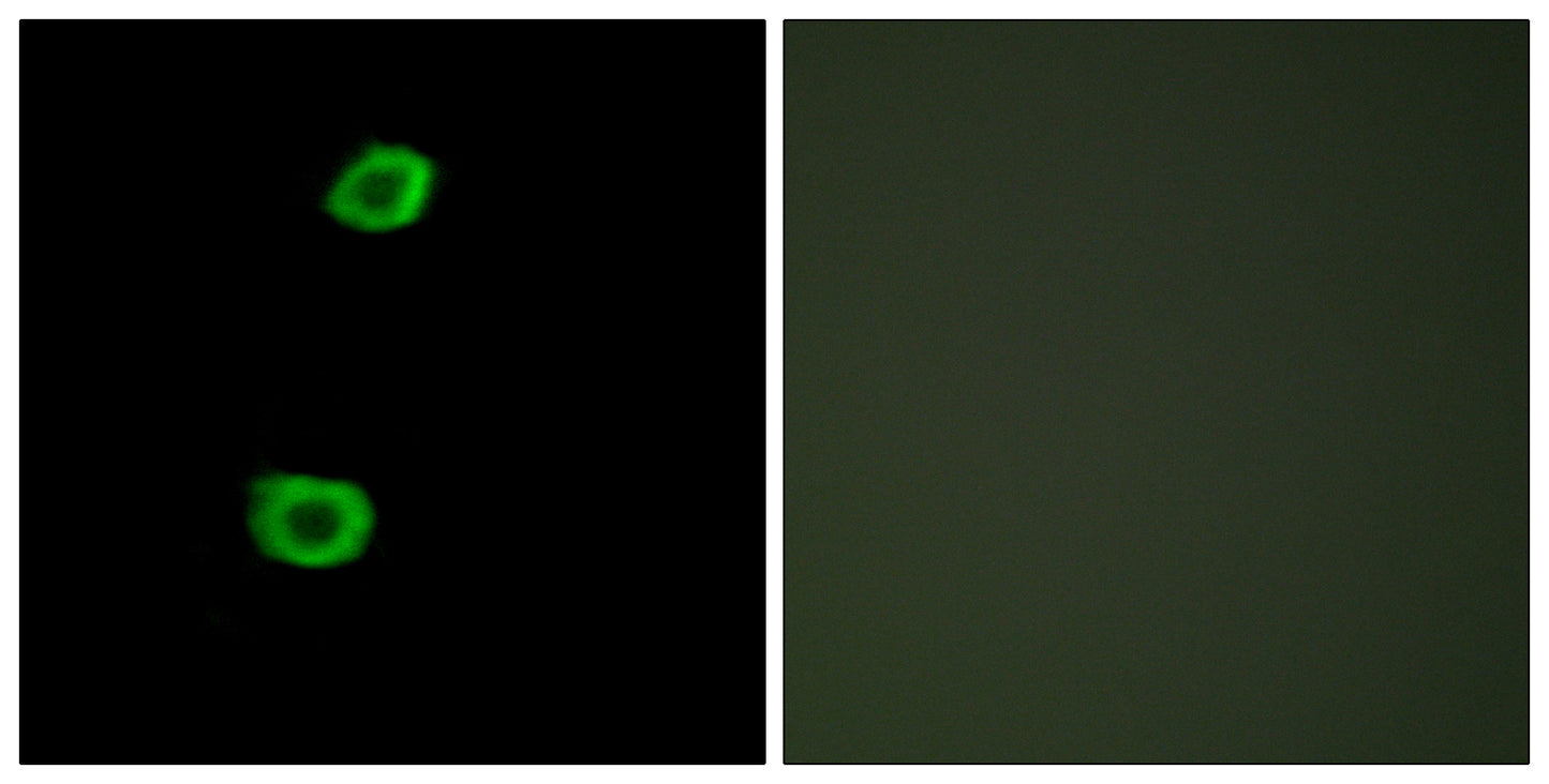 KPI-2 Rabbit Polyclonal Antibody