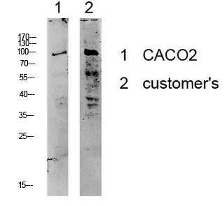 Kv2.1/KCNB1 Rabbit Polyclonal Antibody