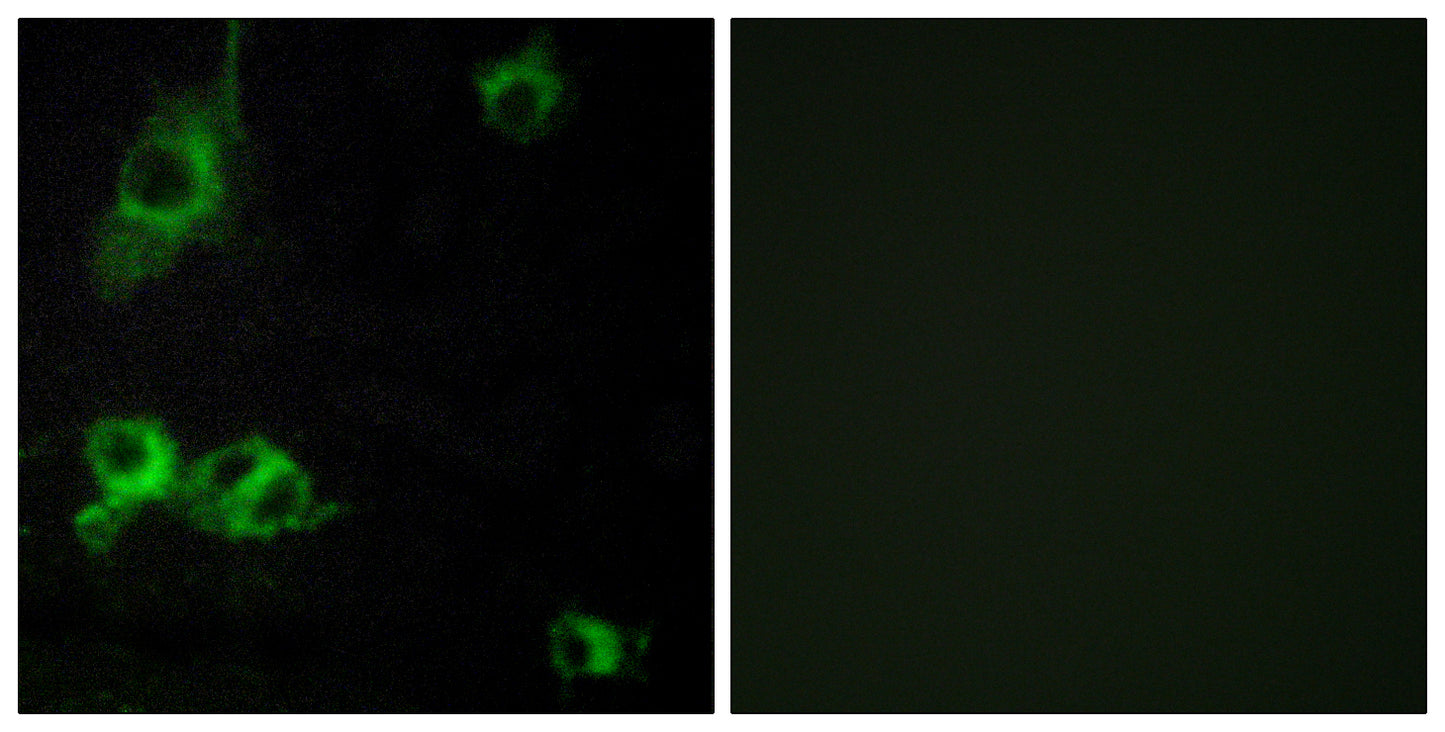 Laminin α-1 Rabbit Polyclonal Antibody
