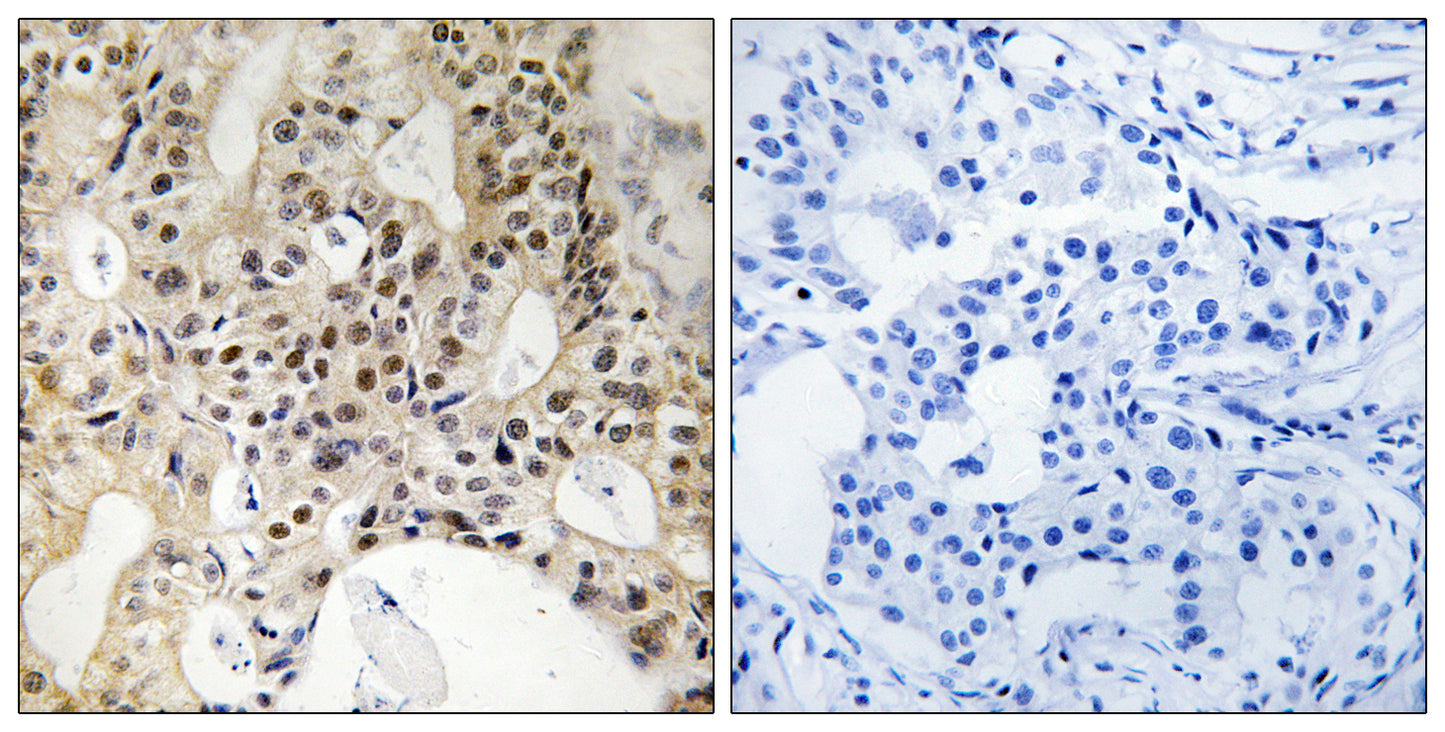 LATS1/2 Rabbit Polyclonal Antibody
