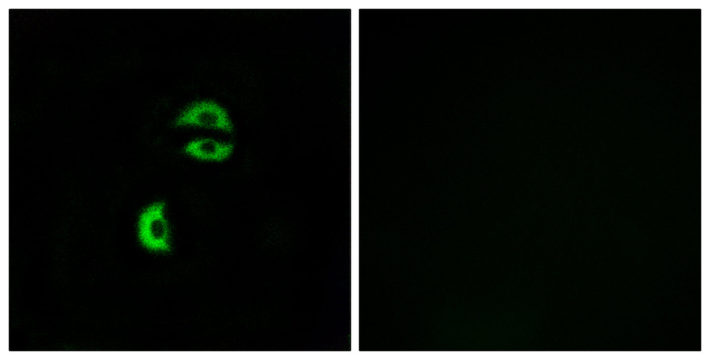 LDLRAD3 Rabbit Polyclonal Antibody