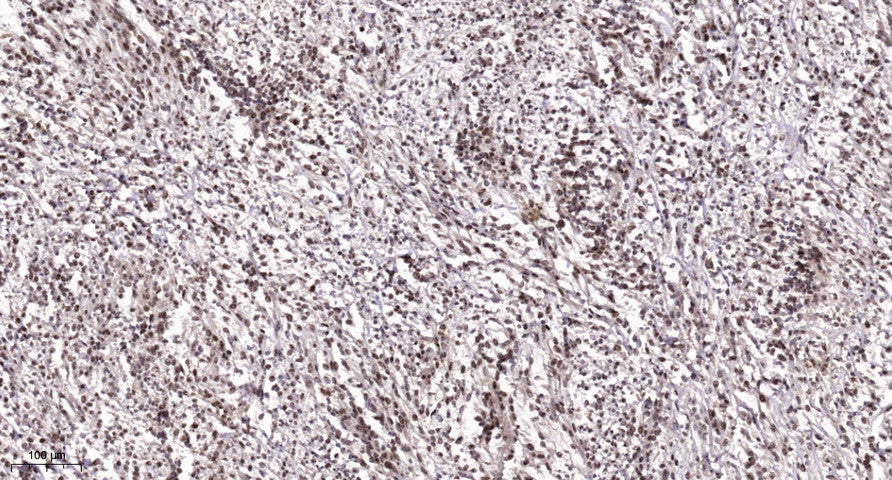 LDOC1 Rabbit Polyclonal Antibody