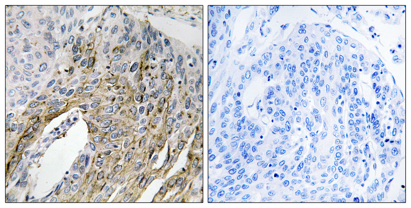 LONP2 Rabbit Polyclonal Antibody