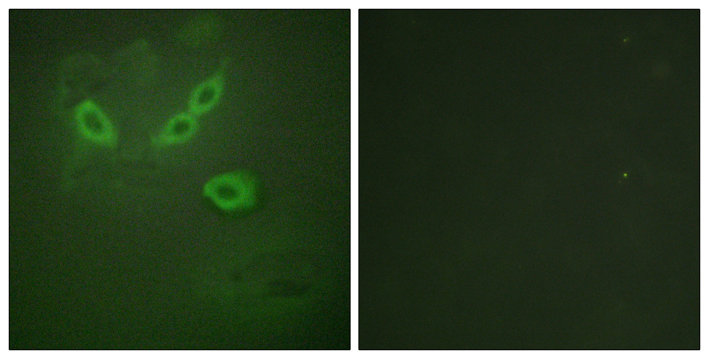 LOST1 Rabbit Polyclonal Antibody