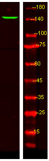 LPHN3 Rabbit Polyclonal Antibody
