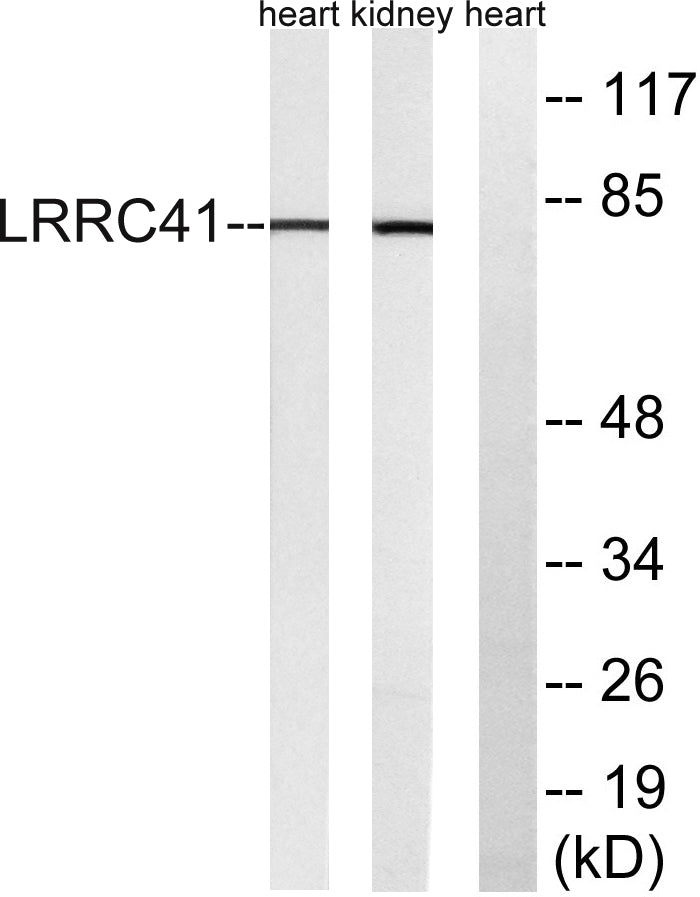 LRRC41 Rabbit Polyclonal Antibody