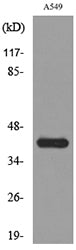L-Selectin Rabbit Polyclonal Antibody