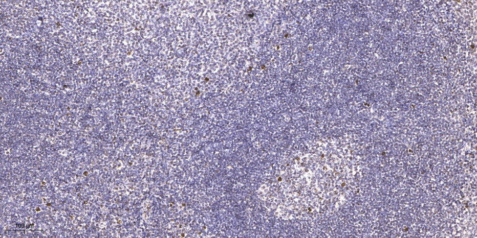 LSM2 Rabbit Polyclonal Antibody